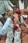 एसडीएम मितौली रेनू मिश्रा का चार वर्षीय बेटा कार दुर्घटना में घायल
